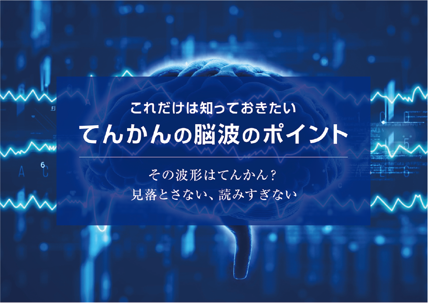 てんかんの脳波のポイント
