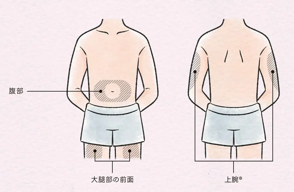 注射部位の選択