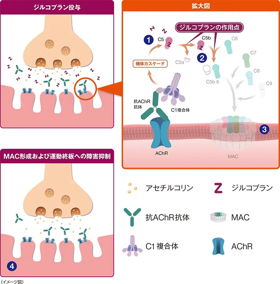 ジルコプランの作用機序